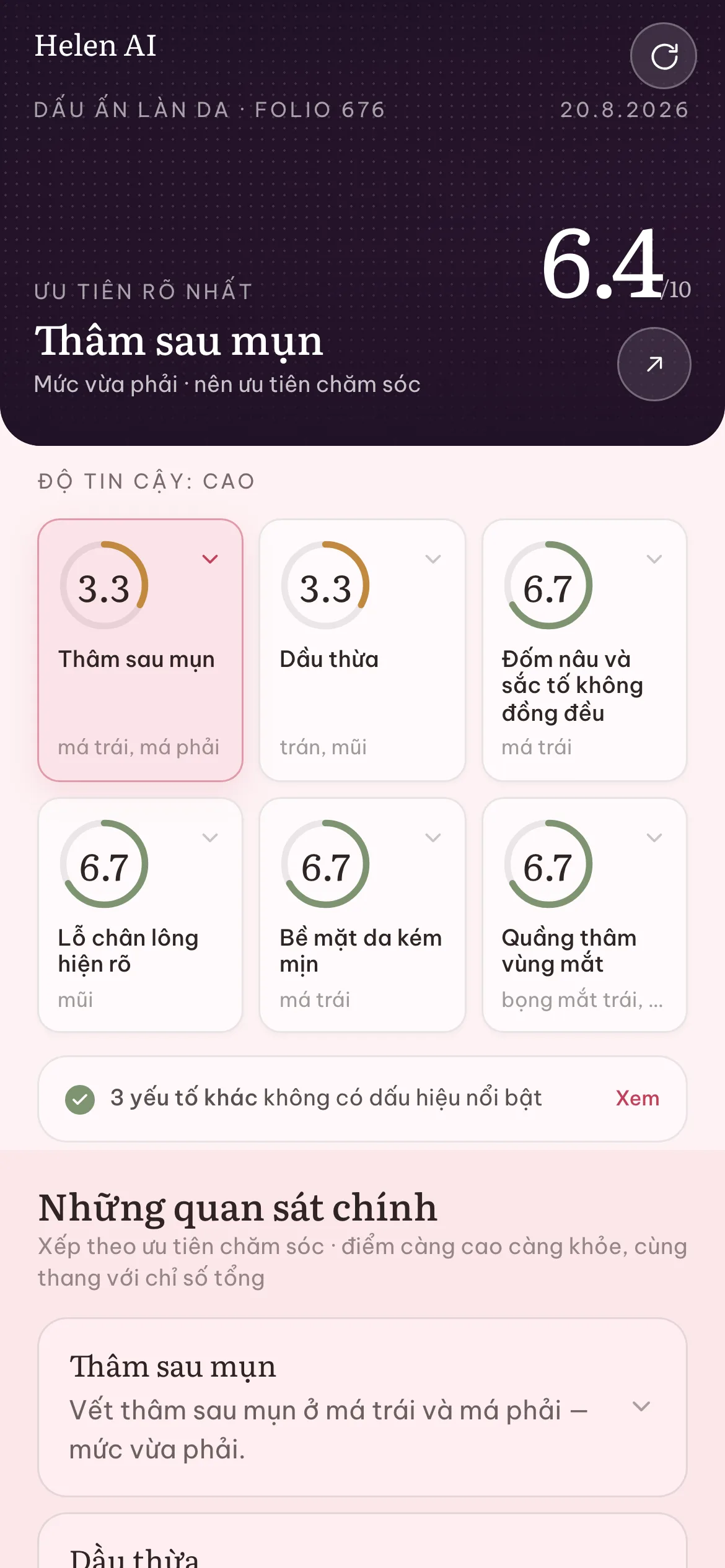 Màn hình báo cáo của Helen AI: chỉ số làn da tổng quan và điểm từng vấn đề